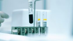 Foto: © Akram Huseyn (https://unsplash.com)